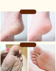 Horse Oil Moisturizing Foot Cream