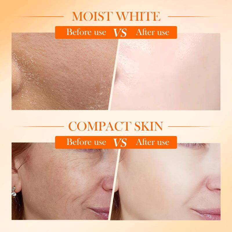 SADOER Vitamin C Face Cream - Brightening, Hydrating Skincare