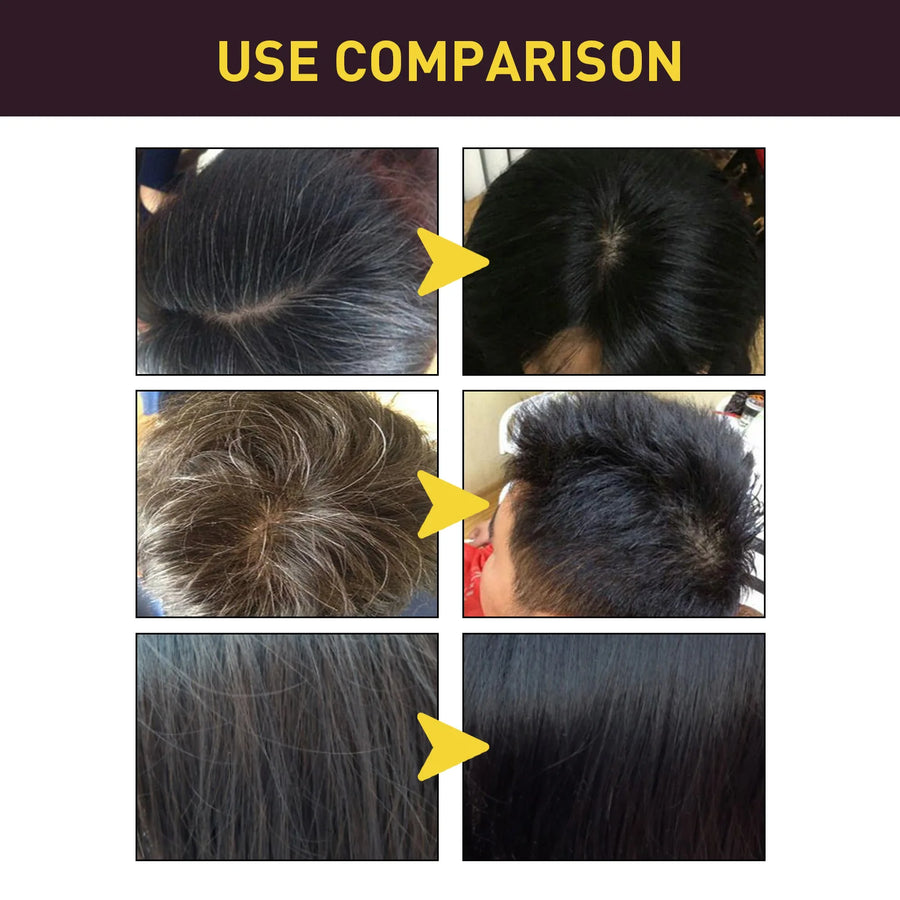 3-in-1 Hair Dye Natural Polygonum Multiflorum Darkening Shampoo for Men & Women