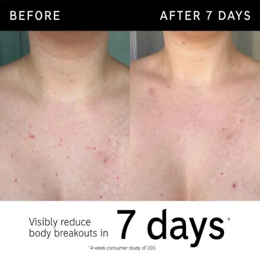 Exfoliating Body Stick - Moisturizing Scrub Lotion for Smooth, Nourished Skin